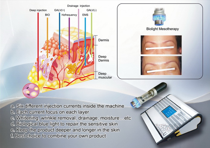 A-04 Product Injection